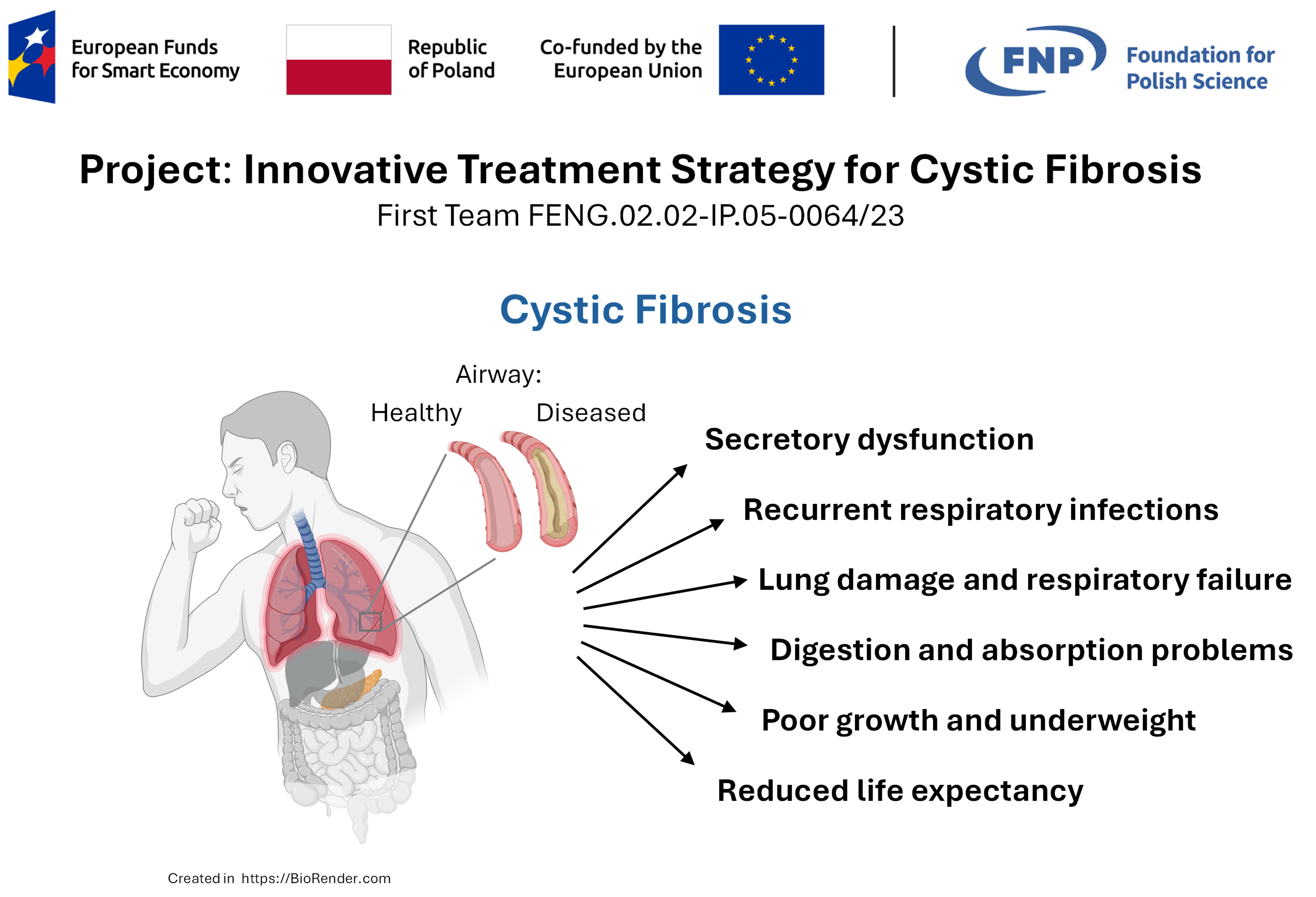 At the top, there is a banner containing four logos with captions, from left to right: European Funds for Smart Economy, Republic of Poland, Funded by the European Union, Foundation for Polish Science. Below, the caption: "Project: Innovative Treatment Strategy for Cystic Fibrosis." Below: First Team FENG.02.02-IP.05-0064/23. Below: "Cystic Fibrosis". Below, there is an illustration of a person (upper part of a body), coughing. The lungs are highlighted in red, and the pancreas is highlighted in yellow. The other digestive organs (liver, stomach, large intestine, and small intestine) are shown in gray. A small square shows a section of the lung, which is then enlarged. The enlargement shows a cross-section of the airways. On the left there is a schematic illustration of the cross-section of the airways of a healthy person, with open airways, and on the right, the airways of a sick person, filled with mucus, with very limited airflow. Above this, the caption reads: "Airways: Healthy (left), Diseased (right)." On the right side of the person there are six arrows that radiate outward, leading to the following captions: from top to bottom: "Secretory disfunctions," "Recurrent respiratory infections," "Lung damage and respiratory failure," "Digestion and absorption problems," "Poor growth and underweigh" and "Reduced life expectancy." Below the illustration, the caption reads: "Created in https://BioRender.com."